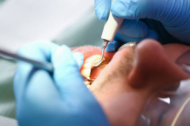Best Emergency Treatment for Oral Infections in Princess Anne, MD