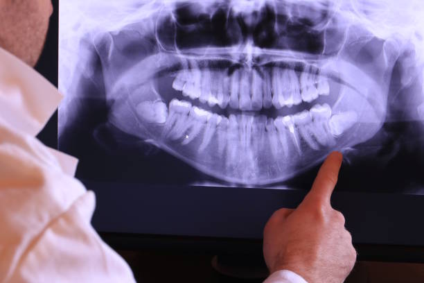 Best Emergency Denture Repair in Princess Anne, MD