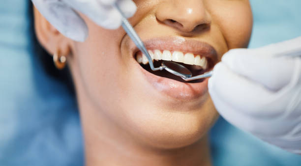 Best Emergency Dental Care for Sports Injuries in Princess Anne, MD