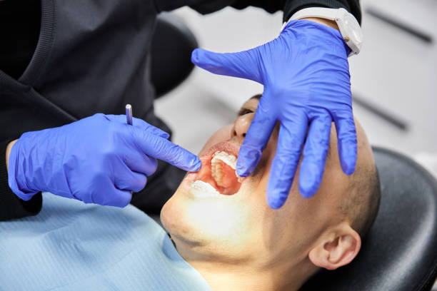 Best Knocked-Out Tooth (Avulsed Tooth) Treatment in Princess Anne, MD