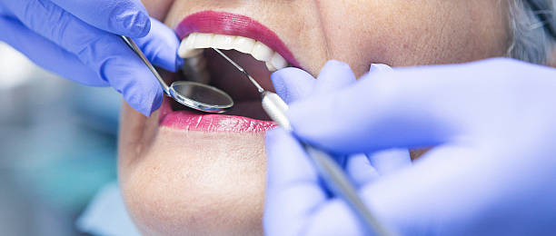 Best Broken or Chipped Tooth Repair in Princess Anne, MD